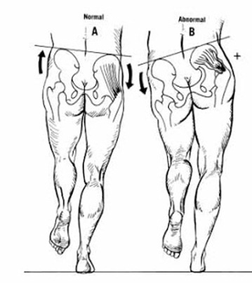 hip drop in runners