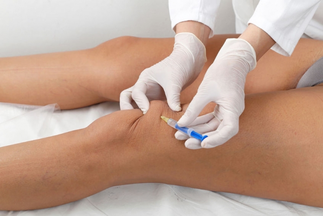 cortisone