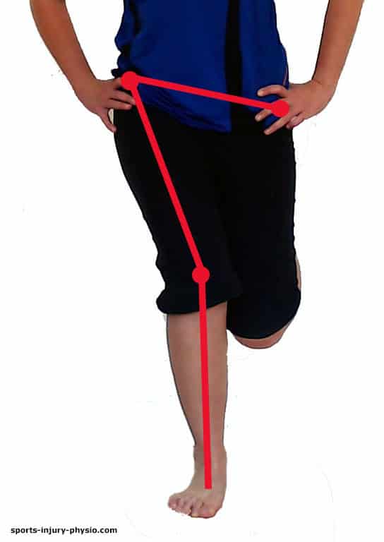 hip stability test