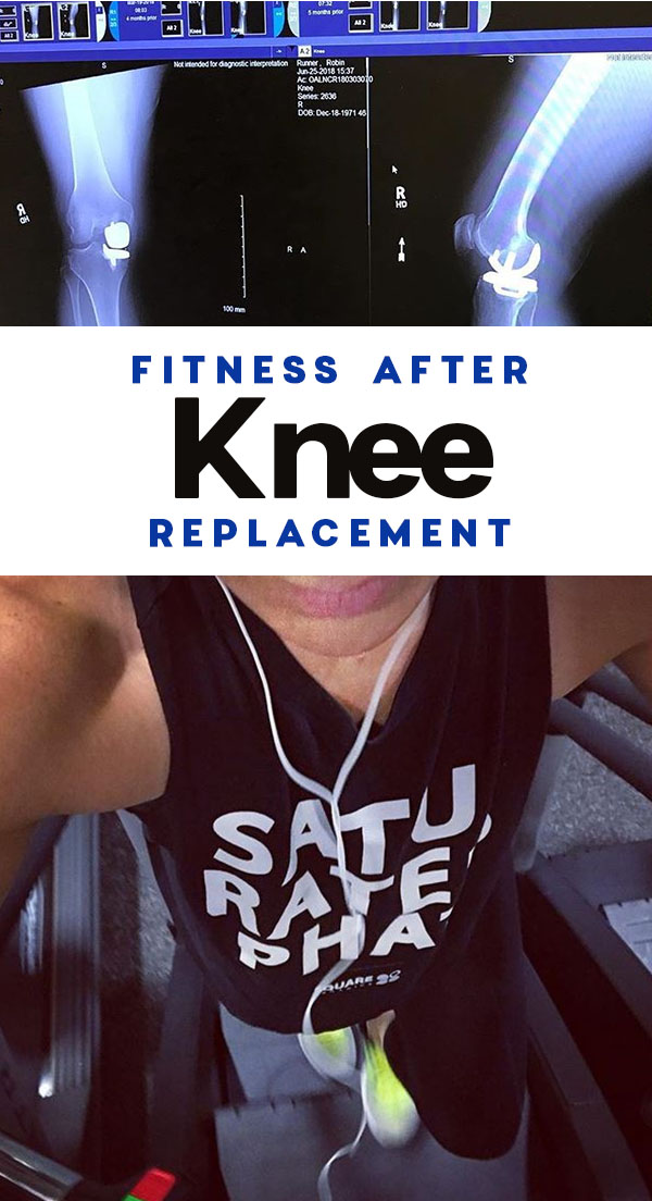 run after knee replacement