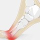 Metatarsalgia running