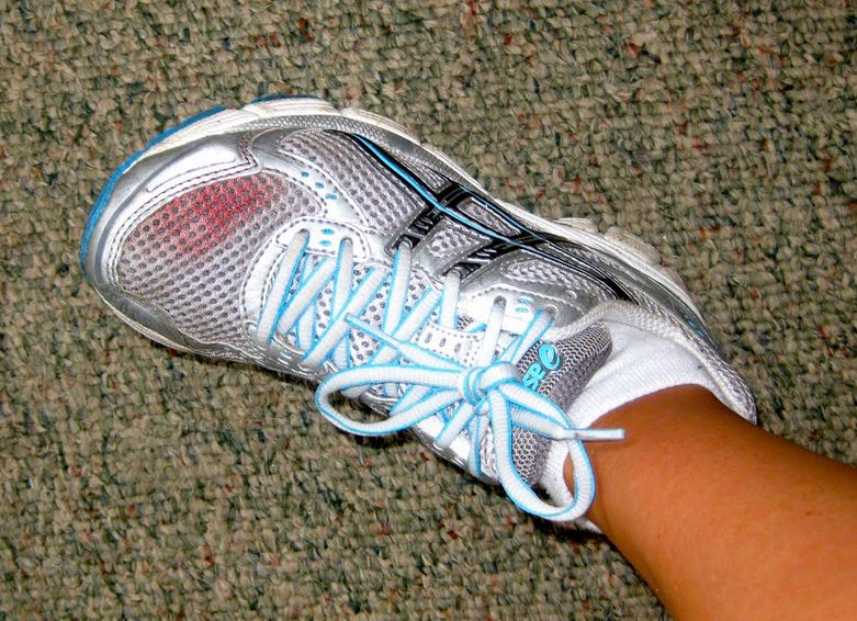 runner's toe