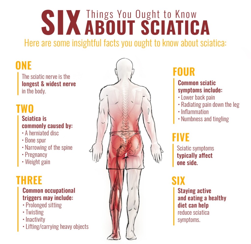 running with sciatica