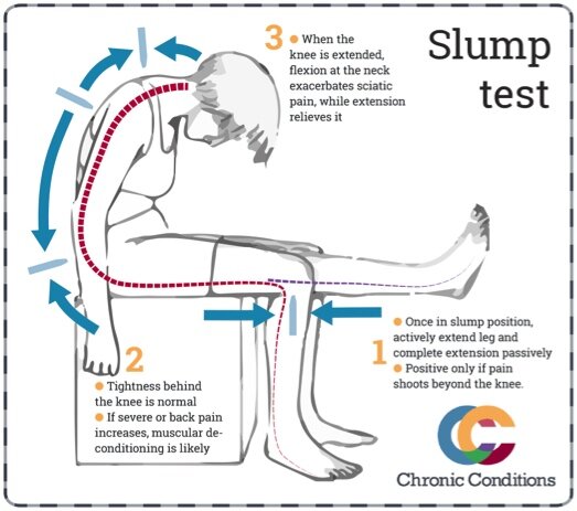 sciatic test