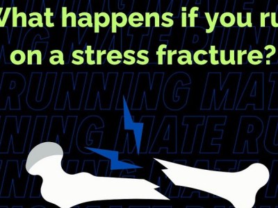 stress fractures in runners